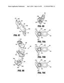 SURGICAL STAPLING APPARATUS diagram and image