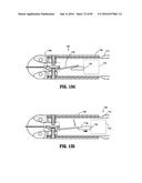 SURGICAL STAPLING APPARATUS diagram and image