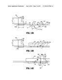 SURGICAL STAPLING APPARATUS diagram and image