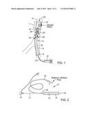 PERFUSION DEVICE FOR TREATING AN INJURED BLOOD VESSEL diagram and image