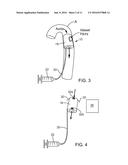 PERFUSION DEVICE FOR TREATING AN INJURED BLOOD VESSEL diagram and image