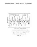 PERFUSION DEVICE FOR TREATING AN INJURED BLOOD VESSEL diagram and image