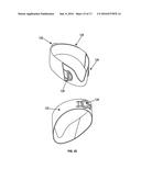 Methods and Devices to Reduce the Likelihood of Injury from Concussive or     Blast Forces diagram and image