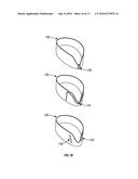 Methods and Devices to Reduce the Likelihood of Injury from Concussive or     Blast Forces diagram and image