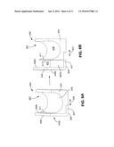 Method and Apparatus for Endoscopic Ligament Release diagram and image