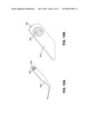 Method and Apparatus for Endoscopic Ligament Release diagram and image