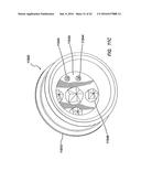 NATURAL ORIFICE SURGERY SYSTEM diagram and image