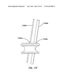 NATURAL ORIFICE SURGERY SYSTEM diagram and image