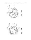 METHOD AND APPARATUS FOR SPINAL STABILIZATION diagram and image