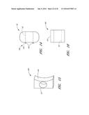 METHOD AND APPARATUS FOR SPINAL STABILIZATION diagram and image