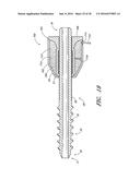 METHOD AND APPARATUS FOR SPINAL STABILIZATION diagram and image