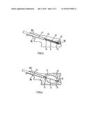 DEVICE FOR STRAIGHTENING AND STABILIZING THE VERTEBRAL COLUMN diagram and image