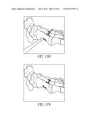 BONE PLATE FOR REDUCING ANGULAR BONE DEFORMITY AND METHOD OF USING diagram and image