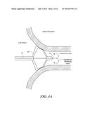 CONTRAST AGENT TO ASSESS QUALITY OF OCCLUSION THROUGH IMPEDANCE     MEASUREMENT diagram and image