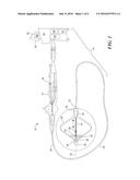 DETERMINATION OF PULMONARY VEIN AND OTHER VASCULAR OCCLUSION USING     TEMPERATURE PROFILE FOLLOWING COLD SALINE INJECTION diagram and image