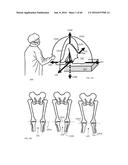 SYSTEM FOR SURGICAL INFORMATION AND FEEDBACK DISPLAY diagram and image