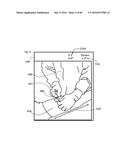 SYSTEM FOR SURGICAL INFORMATION AND FEEDBACK DISPLAY diagram and image