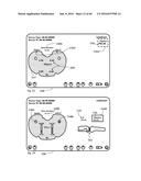 SYSTEM FOR SURGICAL INFORMATION AND FEEDBACK DISPLAY diagram and image