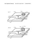 SYSTEM FOR SURGICAL INFORMATION AND FEEDBACK DISPLAY diagram and image