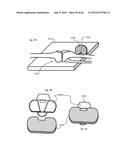 SYSTEM FOR SURGICAL INFORMATION AND FEEDBACK DISPLAY diagram and image