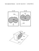 SYSTEM FOR SURGICAL INFORMATION AND FEEDBACK DISPLAY diagram and image