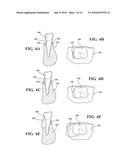 MATERIAL DEPOSITION DEVICE AND METHOD OF USE diagram and image