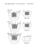 MATERIAL DEPOSITION DEVICE AND METHOD OF USE diagram and image