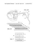 MATERIAL DEPOSITION DEVICE AND METHOD OF USE diagram and image