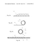 Graft Devices and Methods of Fabrication diagram and image