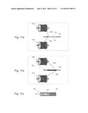 Graft Devices and Methods of Fabrication diagram and image