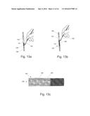 Graft Devices and Methods of Fabrication diagram and image