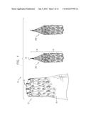 ENDOVASCULAR FENESTRATED STENT-GRAFTING diagram and image