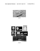 TISSUE INTERFACE AUGMENTATION DEVICE FOR LIGAMENT/TENDON RECONSTRUCTION diagram and image