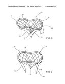 INTRACARDIAC DEVICE TO CORRECT MITRAL REGURGITATION diagram and image