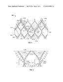 VALVE CUFF SUPPORT diagram and image