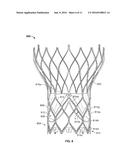 VALVE CUFF SUPPORT diagram and image