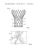 VALVE CUFF SUPPORT diagram and image