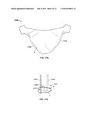 VALVE CUFF SUPPORT diagram and image