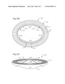 PROSTHETIC MITRAL VALVE diagram and image