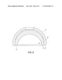 SELF-CENTERING, ANTI-SEIZING ACETABULAR LINER diagram and image