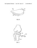 Devices and Methods for Tissue Engineering diagram and image