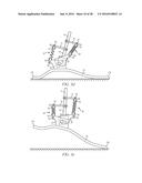 Quasi-Active Prosthetic Joint System diagram and image