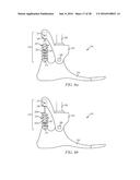 Quasi-Active Prosthetic Joint System diagram and image