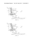 Quasi-Active Prosthetic Joint System diagram and image