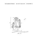 Quasi-Active Prosthetic Joint System diagram and image