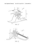 Quasi-Active Prosthetic Joint System diagram and image