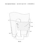 Adaptable Socket System, Method, and Kit diagram and image