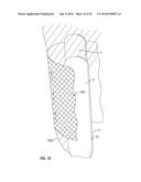 Adaptable Socket System, Method, and Kit diagram and image