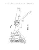 ADJUSTABLE CERVICAL COLLAR diagram and image