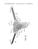 ADJUSTABLE CERVICAL COLLAR diagram and image